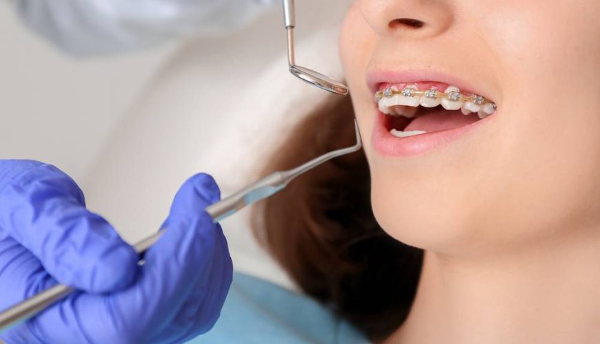 Steps To Prepare For Your First Orthodontist Visit